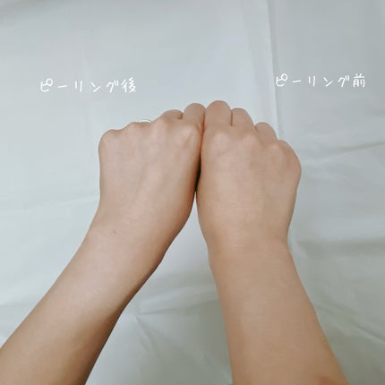 ヒーリンピーリンプロスペックピーリングジェル/素数/ボディスクラブを使ったクチコミ(6枚目)