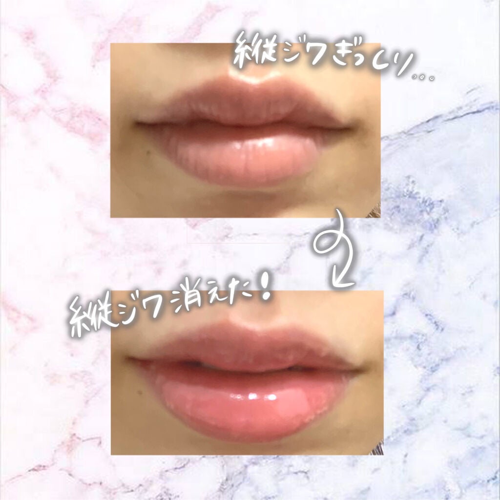 MAAs リップセラム/Dr. Choi's Solution/リップ美容液を使ったクチコミ(3枚目)