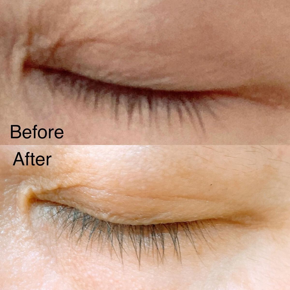 EMAKED（エマーキット）/水橋保寿堂製薬/まつげ美容液を使ったクチコミ（3枚目）