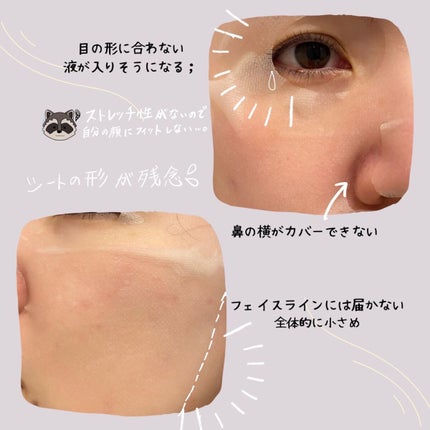 ダーマレーザー スーパーNMN100マスク/クオリティファースト/シートマスク・パックを使ったクチコミ(3枚目)