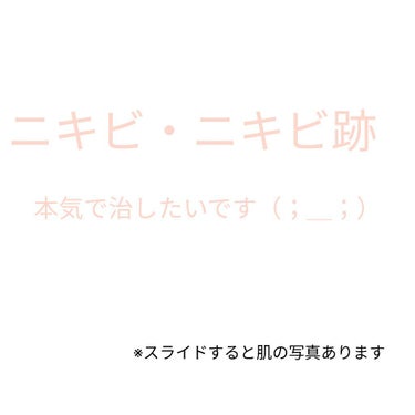 バイオイル/バイオイル/フェイスオイルを使ったクチコミ（1枚目）