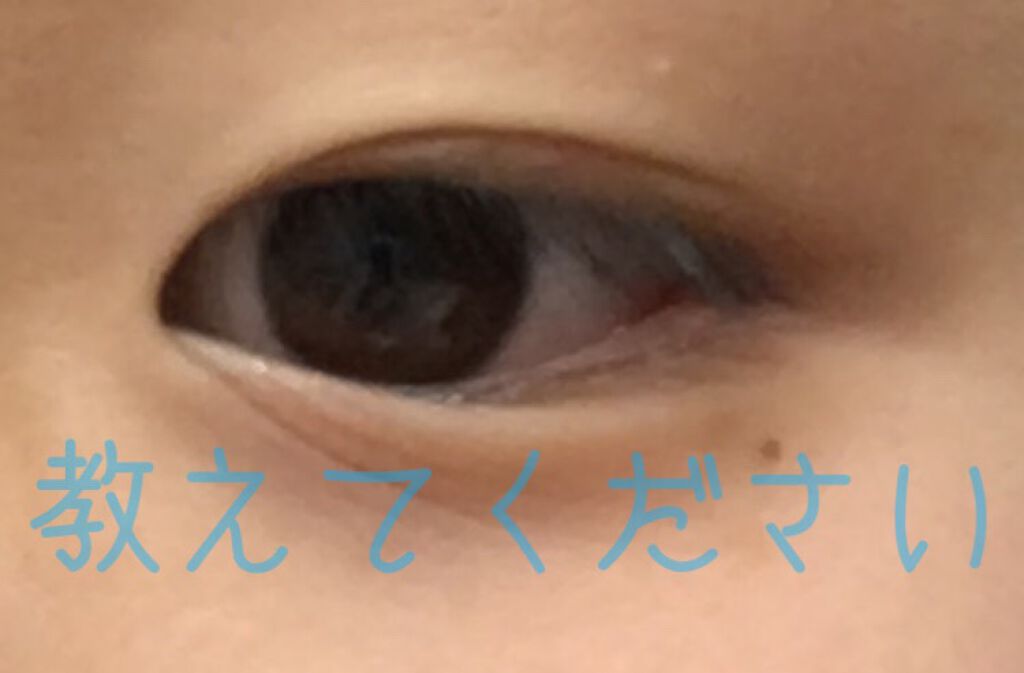 oimo on LIPS 「二重幅の広げ方教えて欲しいです!見た方、わかる方は教えてくださ..」(2枚目)