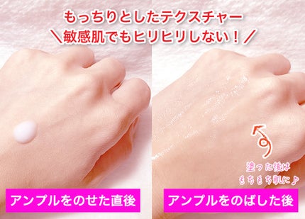 プロバイオシカ インテンシブ アンプル/SKIN1004/美容液を使ったクチコミ(3枚目)
