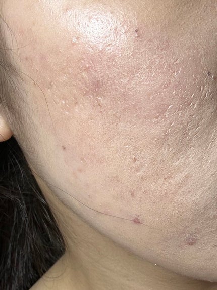 ミネラルBBパウダー EM(エンリッチモイスト)/毛穴パテ職人/プレストパウダーを使ったクチコミ(3枚目)