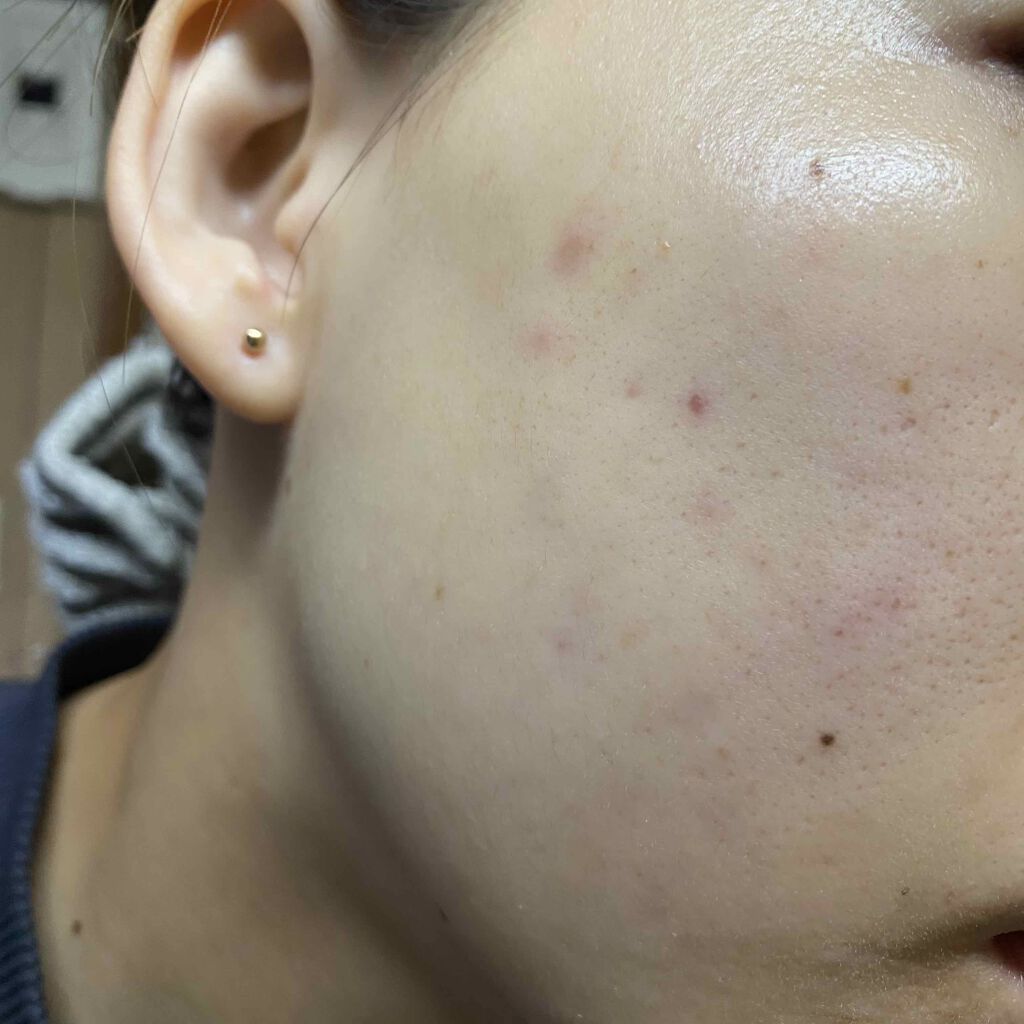 ザ・タイムR アクア/IPSA/化粧水を使ったクチコミ（1枚目）