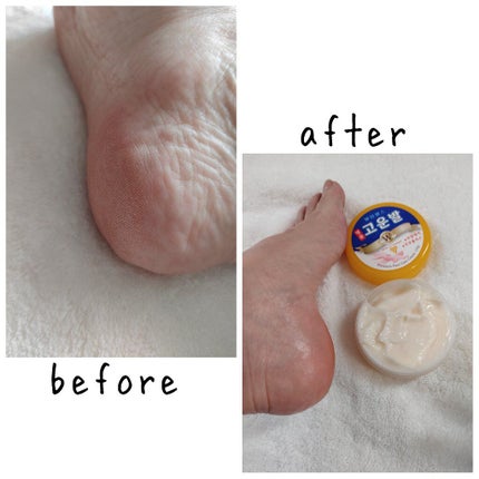 ゴウンバル クリーム/3WB/レッグ・フットケアを使ったクチコミ(4枚目)