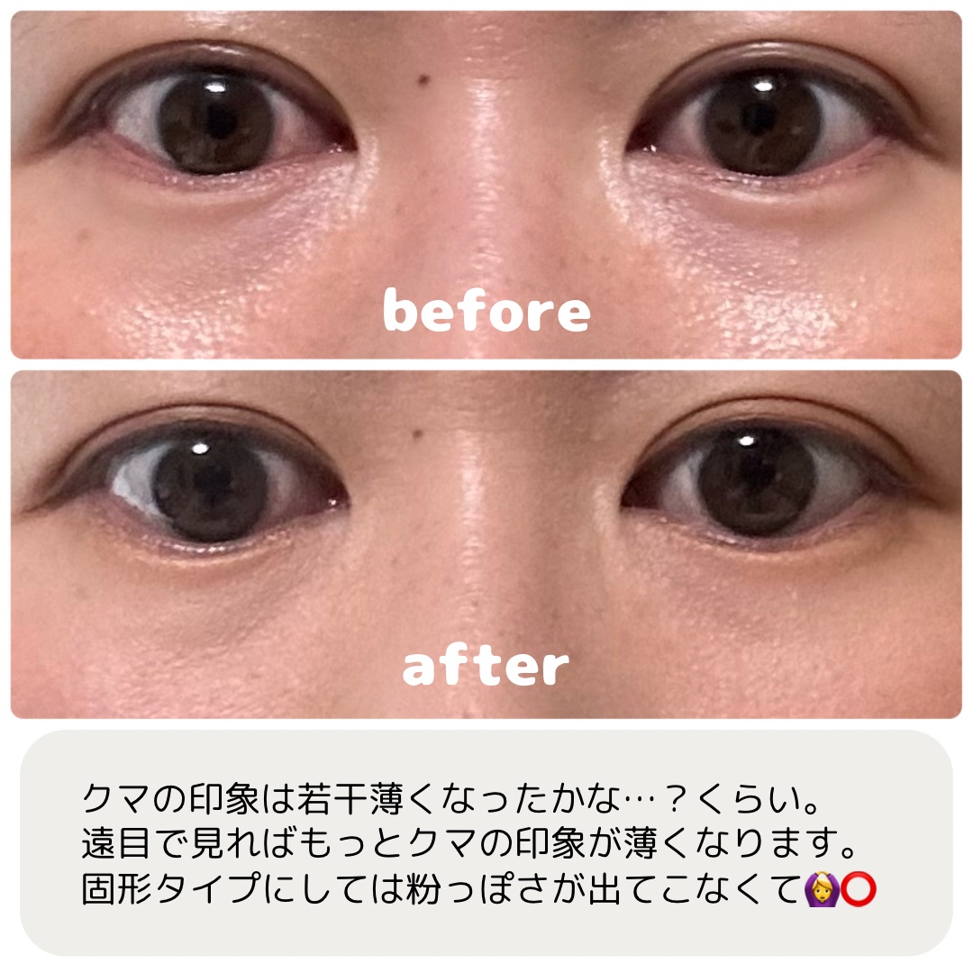 ピンポイントカラースナイパー/KATE/スティックコンシーラーを使ったクチコミ（3枚目）