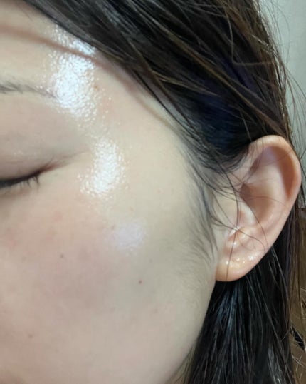 シャンティ on LIPS 「\キュリペアーラインで人気のクリーム/\効果が1番分かりやすい..」(6枚目)