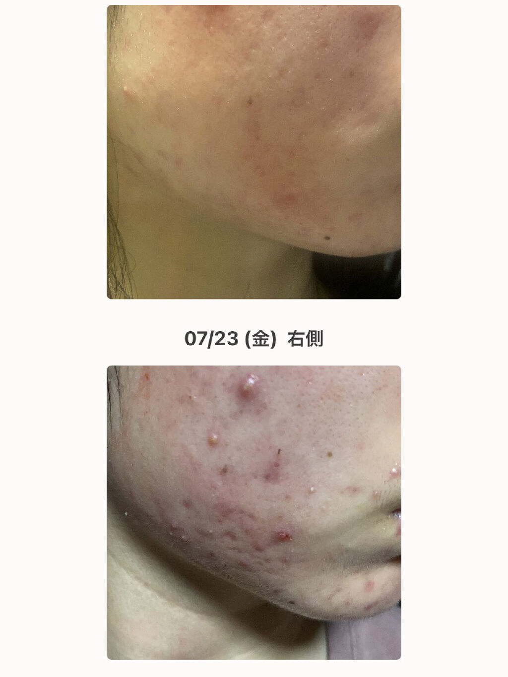 を使ったクチコミ（2枚目）