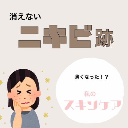 ロゼット洗顔パスタ アクネクリア/ロゼット/洗顔フォームを使ったクチコミ(1枚目)