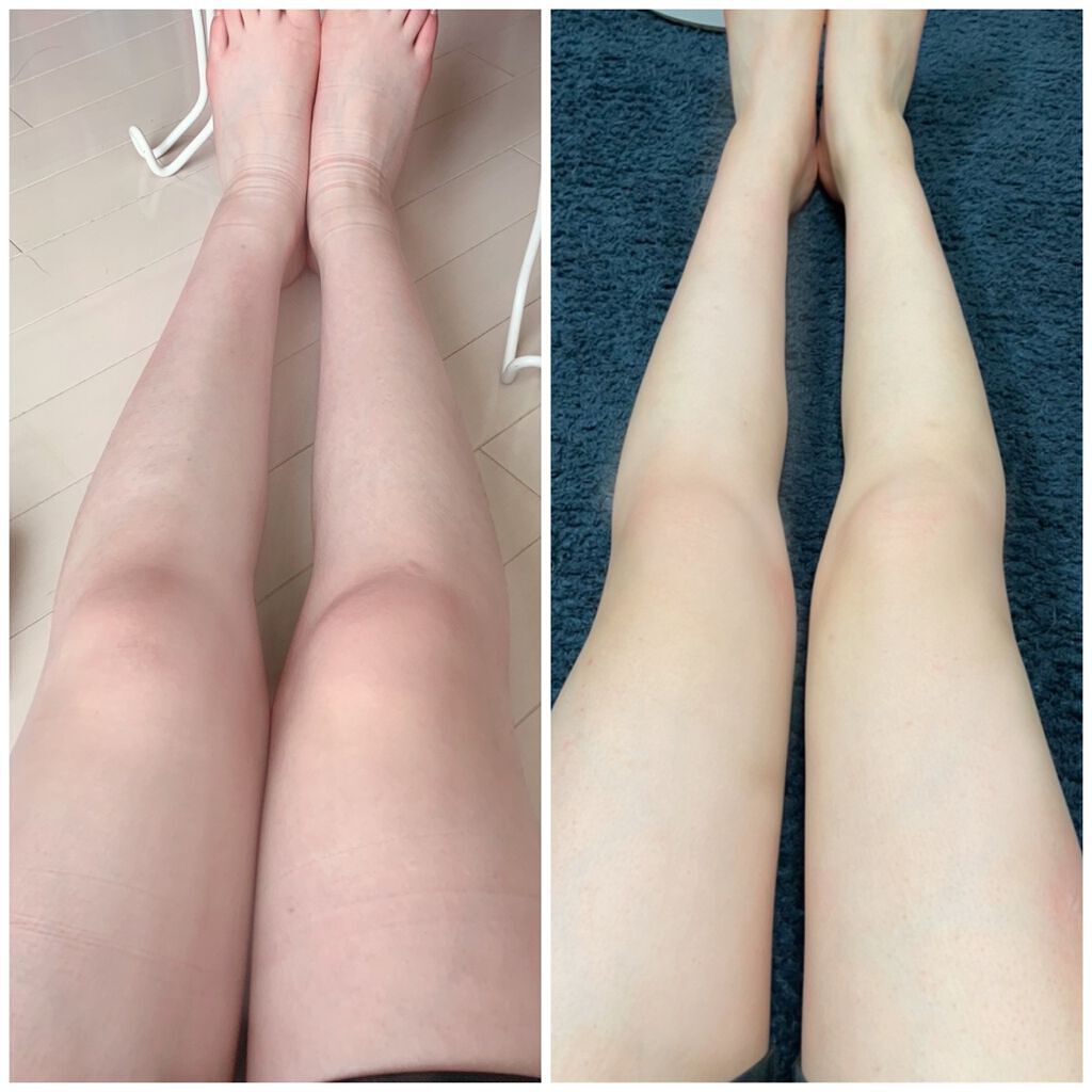 もも on LIPS 「おすすめの脚やせ🌟🌟私の脚やせ方法を紹介します!!!ざっとした..」(1枚目)