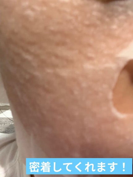 毛穴小町マスク /クリアターン/シートマスク・パックを使ったクチコミ(6枚目)