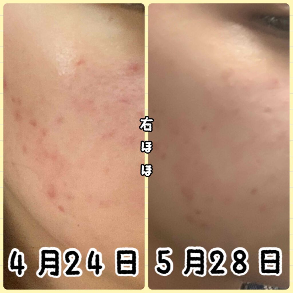 ソフティモ 薬用ホワイト クレンジングウォッシュ/ソフティモ/洗顔フォームを使ったクチコミ（2枚目）