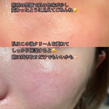 シカピーリングトナーパッド/ONE THING/トナーパッドを使ったクチコミ(4枚目)