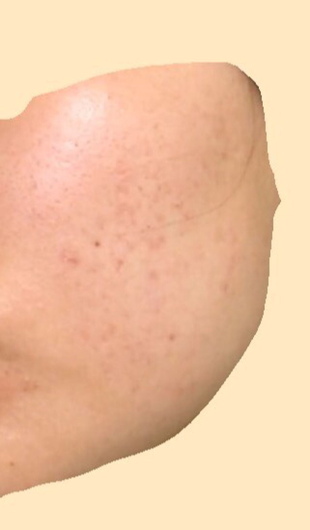 白潤 薬用美白化粧水/肌ラボ/化粧水を使ったクチコミ（2枚目）