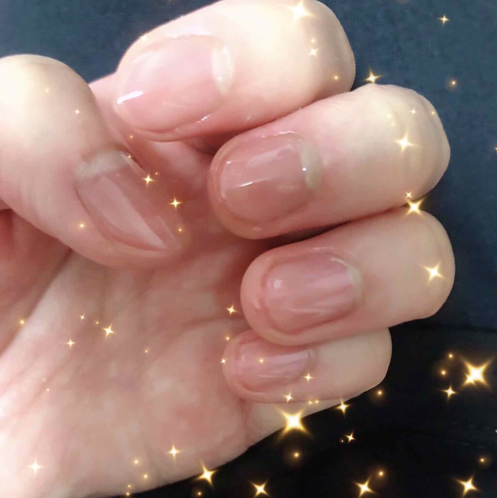 ネイルケア・オイル/ドクター・ショール/ネイルオイル・トリートメントを使ったクチコミ（2枚目）