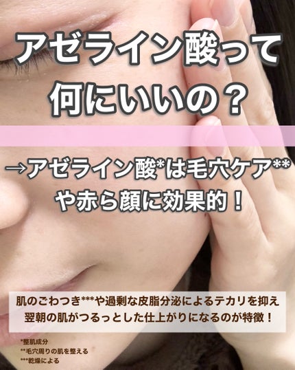 ダーマセラム アゼライン酸5%/SHIMBI METHOD/美容液を使ったクチコミ(3枚目)