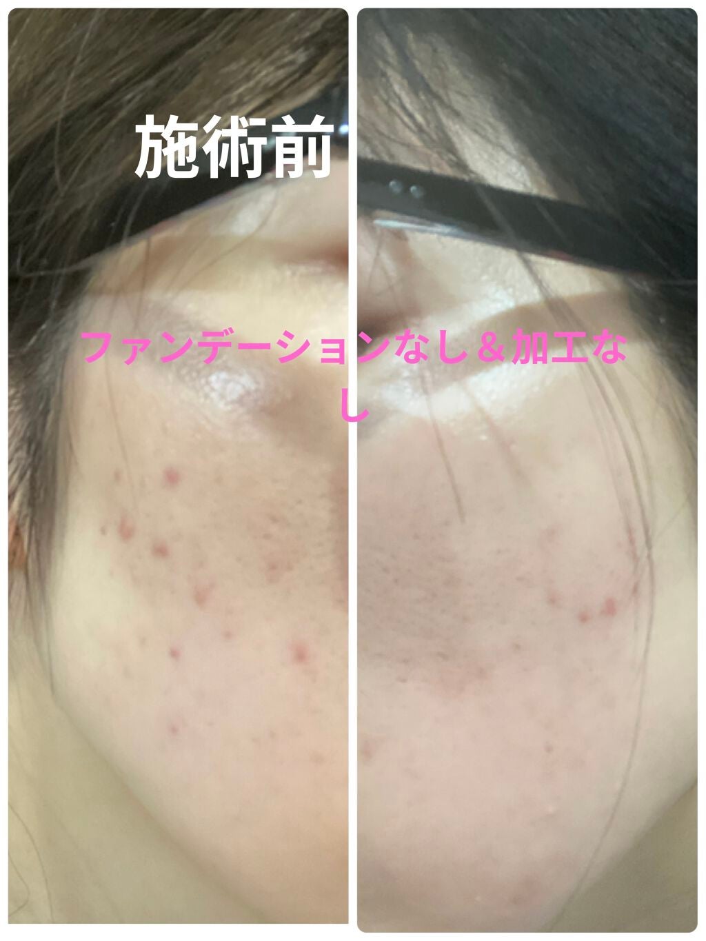 レ キャトル オンブル/CHANEL/アイシャドウパレットを使ったクチコミ(7枚目)