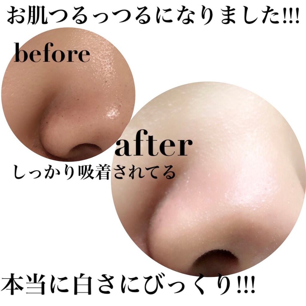 INGマスクパック/PISHABIT/シートマスク・パックを使ったクチコミ(9枚目)