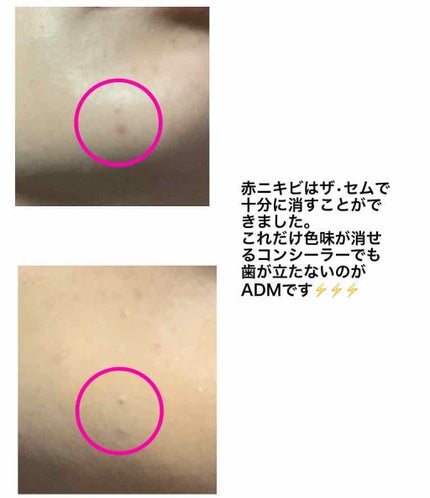 スポッツカバー ファウンデイション/SHISEIDO/クリームコンシーラーを使ったクチコミ(3枚目)
