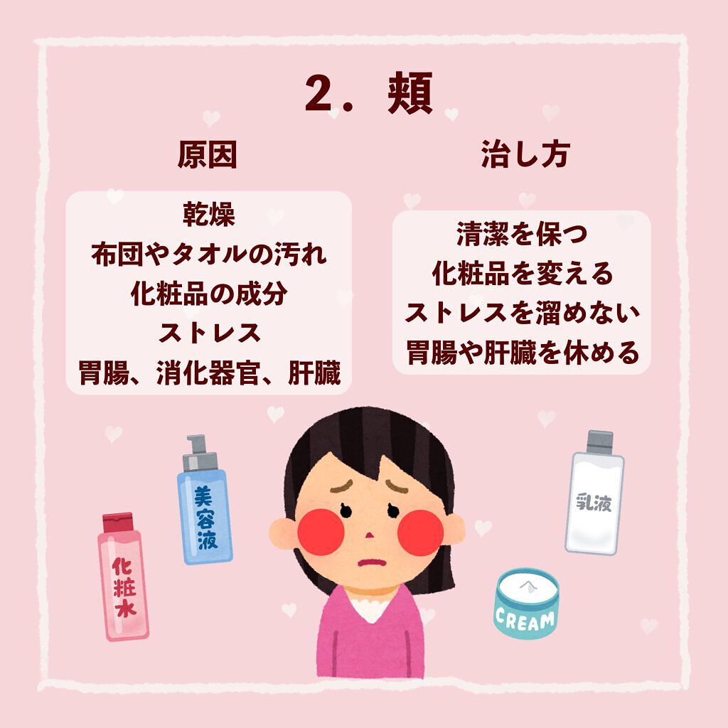 ペアアクネクリームW(医薬品)/ペア/その他を使ったクチコミ(3枚目)