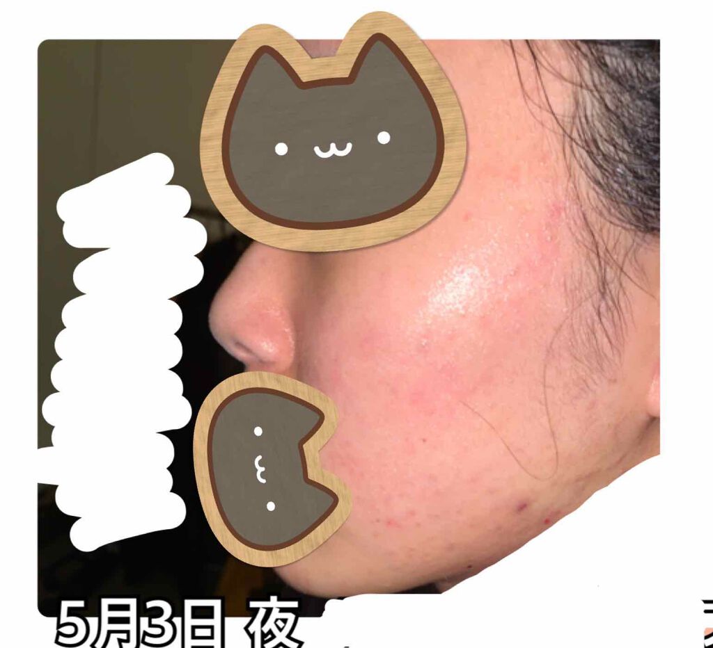 プロポリス エネルギーアンプル/CNP Laboratory/美容液を使ったクチコミ(3枚目)