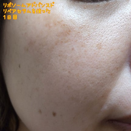 リポソーム アドバンスト リペアセラム/DECORTÉ/美容液を使ったクチコミ(3枚目)