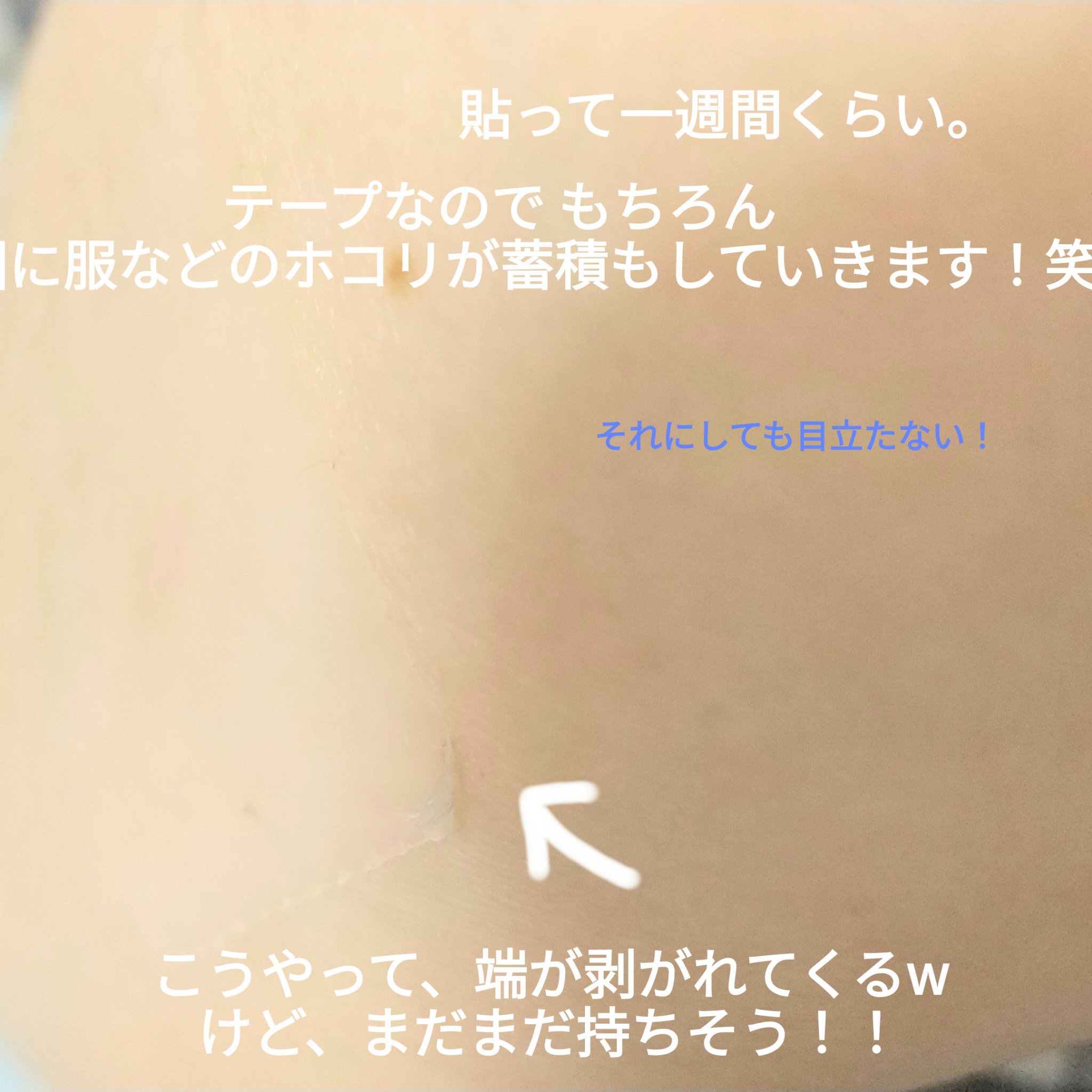 手で切れるハイドロコロイドパッド/matsukiyo/マスクを使ったクチコミ（2枚目）