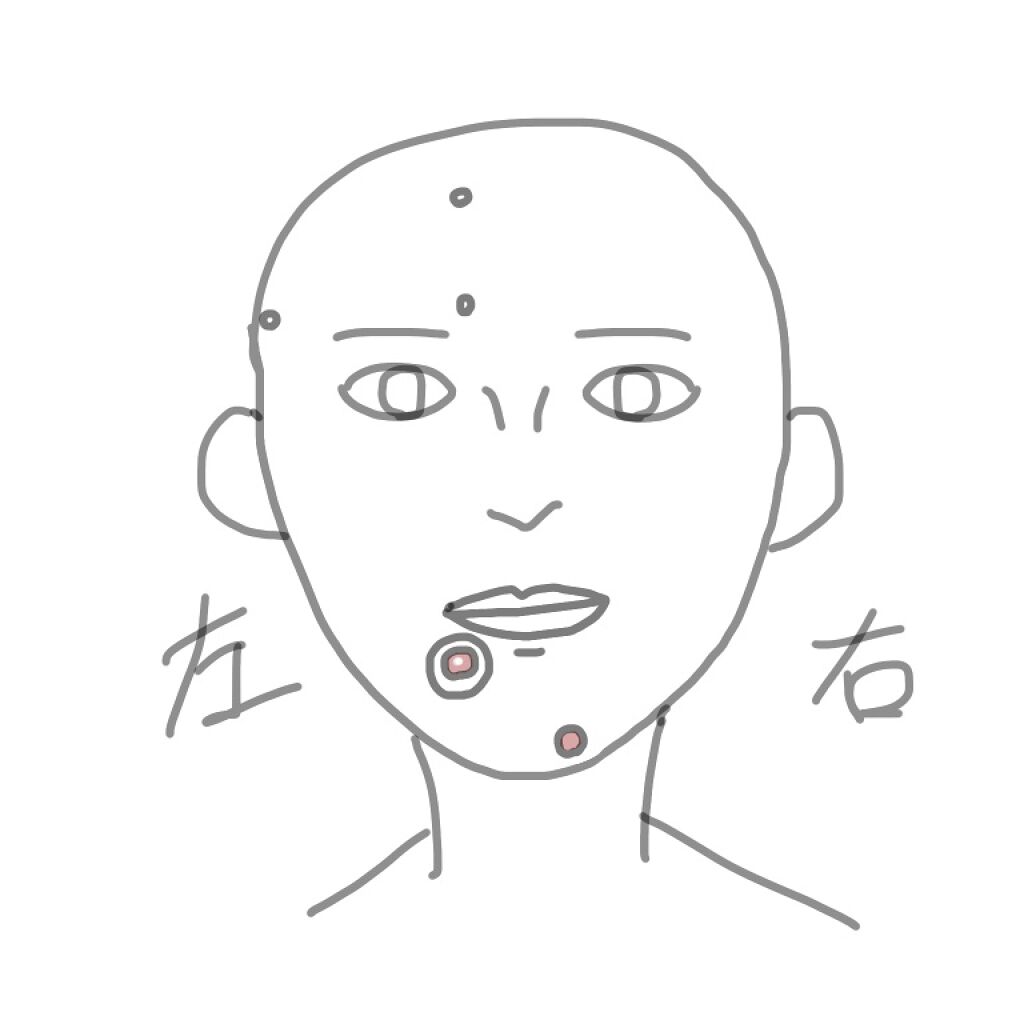 AC SOLUTION CLEAR SPOT PATCH/G9SKIN/にきびパッチを使ったクチコミ（1枚目）