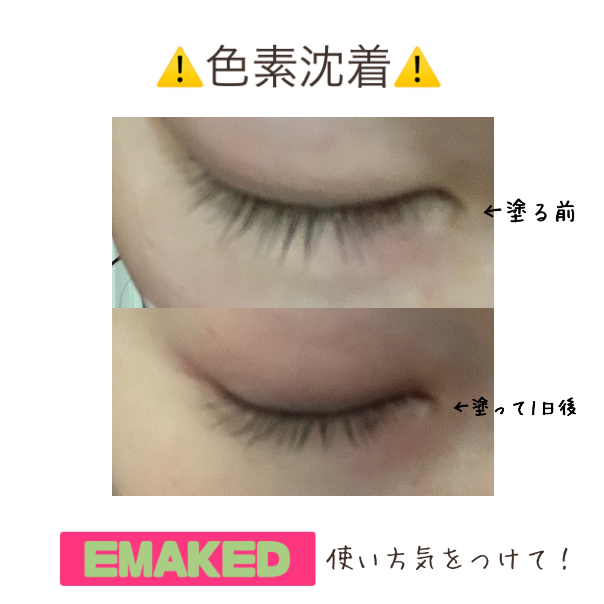 EMAKED（エマーキット）｜水橋保寿堂製薬の効果に関する口コミ