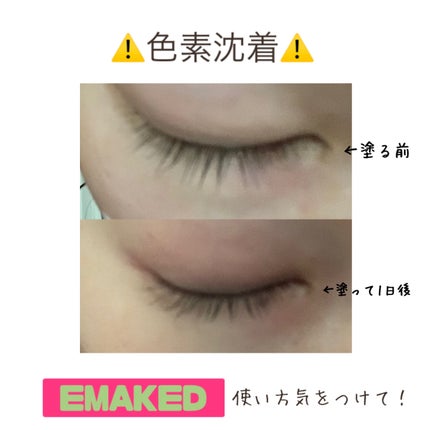 EMAKED(エマーキット)/水橋保寿堂製薬/まつげ美容液を使ったクチコミ(2枚目)