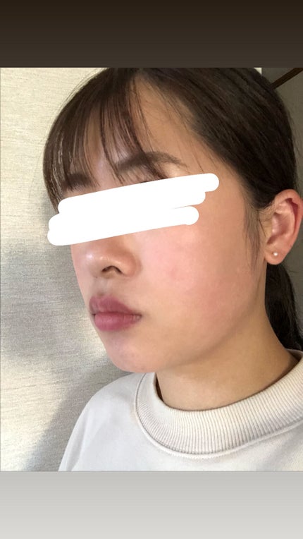 ããªã¬ ã¡ã€ã¯æç¶ã·ãŒã ãããããè/ããªã¬/ãã§ã€ã¹ã·ãŒãã䜿ã£ãã¯ãã³ãïŒ3æç®ïŒ