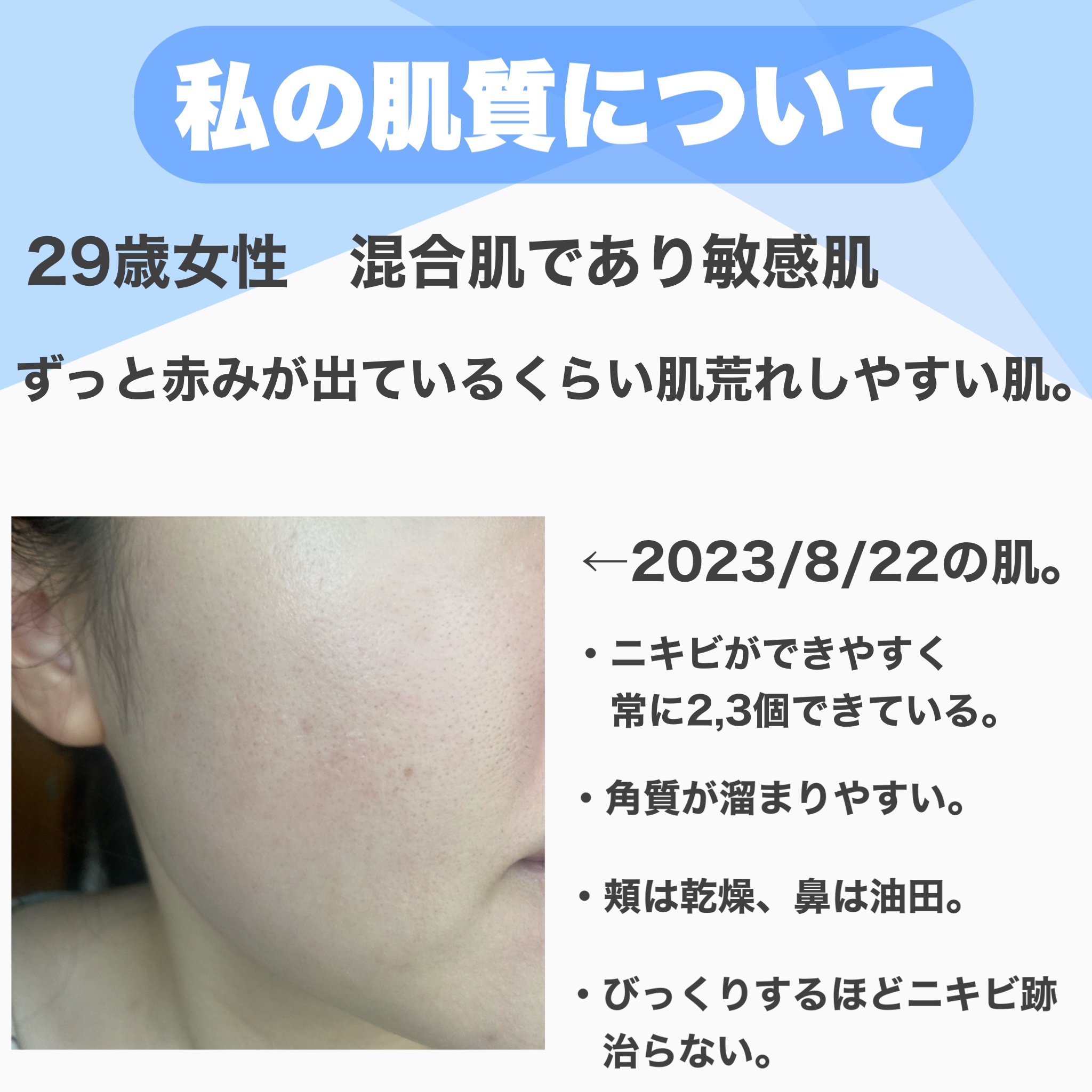 UVミルクEX/NOV/日焼け止めミルクを使ったクチコミ（2枚目）