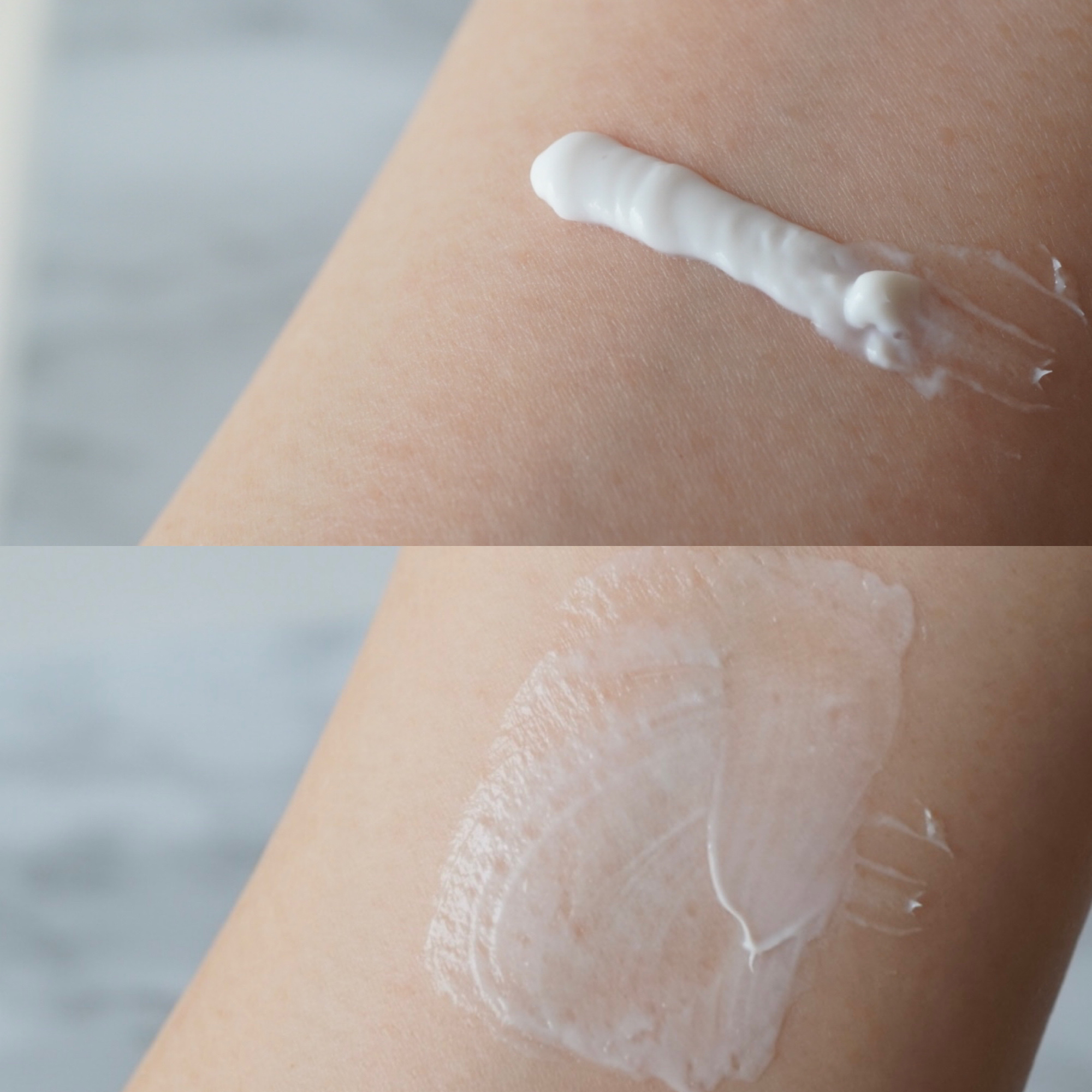 10%尿素配合クリーム 新ケラチナミンコーワクリーム(医薬品)/ケラチナミン/その他を使ったクチコミ（2枚目）