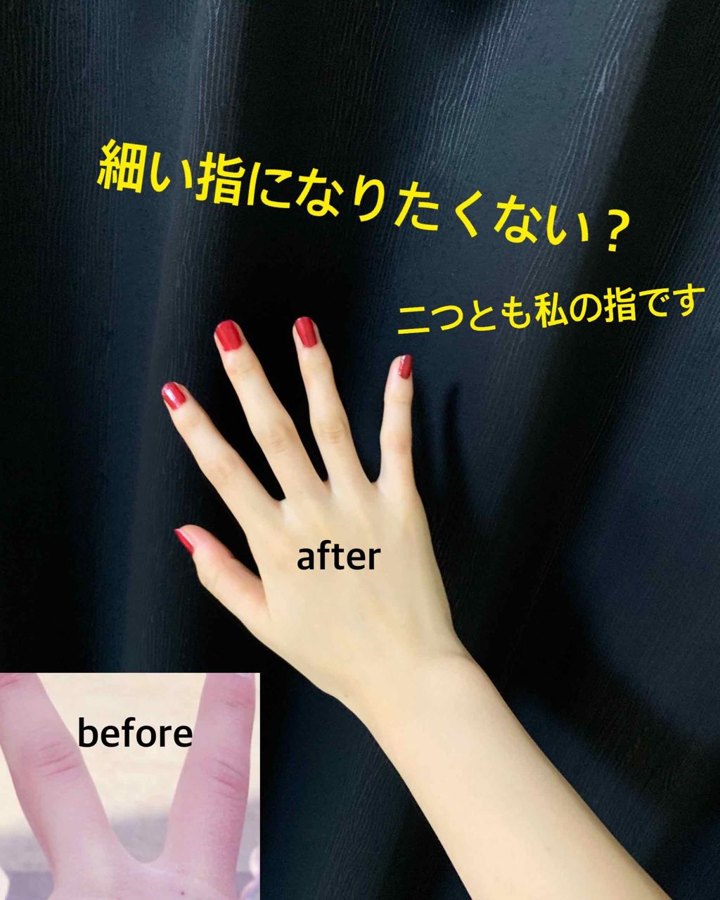 薬用ホワイトニング ハンドクリーム/コエンリッチQ10/ハンドクリームを使ったクチコミ(1枚目)