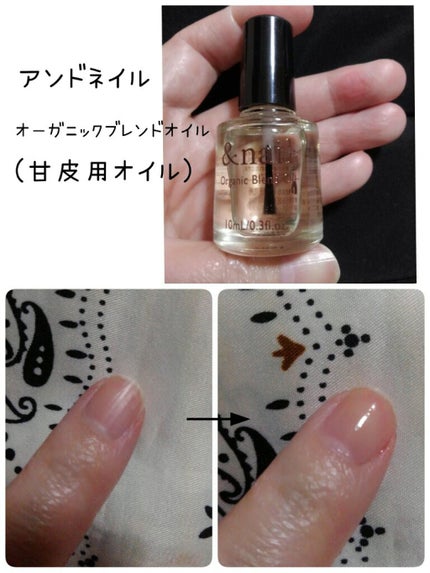 オーガニックブレンドオイル/アンドネイル/ネイルオイル・トリートメントを使ったクチコミ(1枚目)