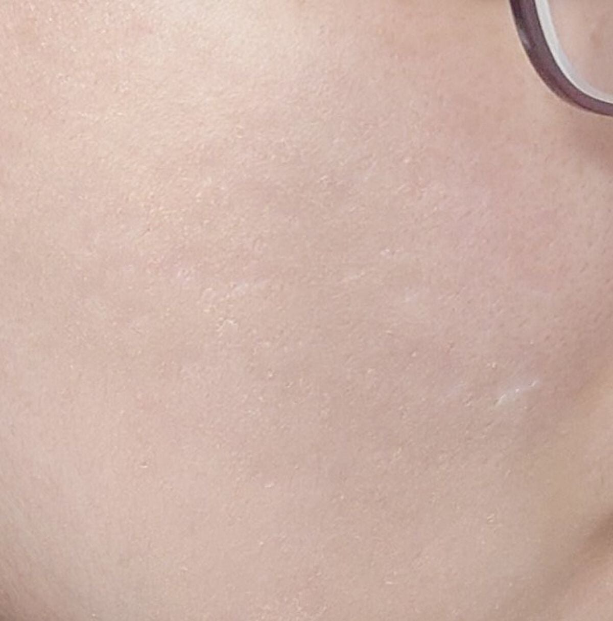 イプノス シーバムクリア リペアクリーム/ACSEINE/フェイスクリームを使ったクチコミ(3枚目)