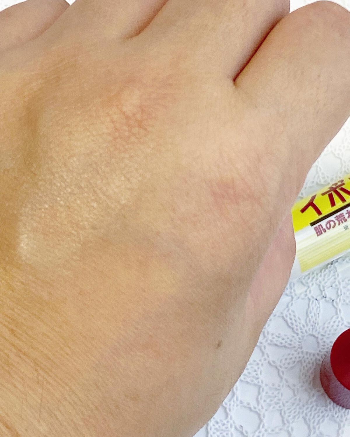 イボンヌ クリーム TA/イボンヌ/その他スキンケアを使ったクチコミ(4枚目)