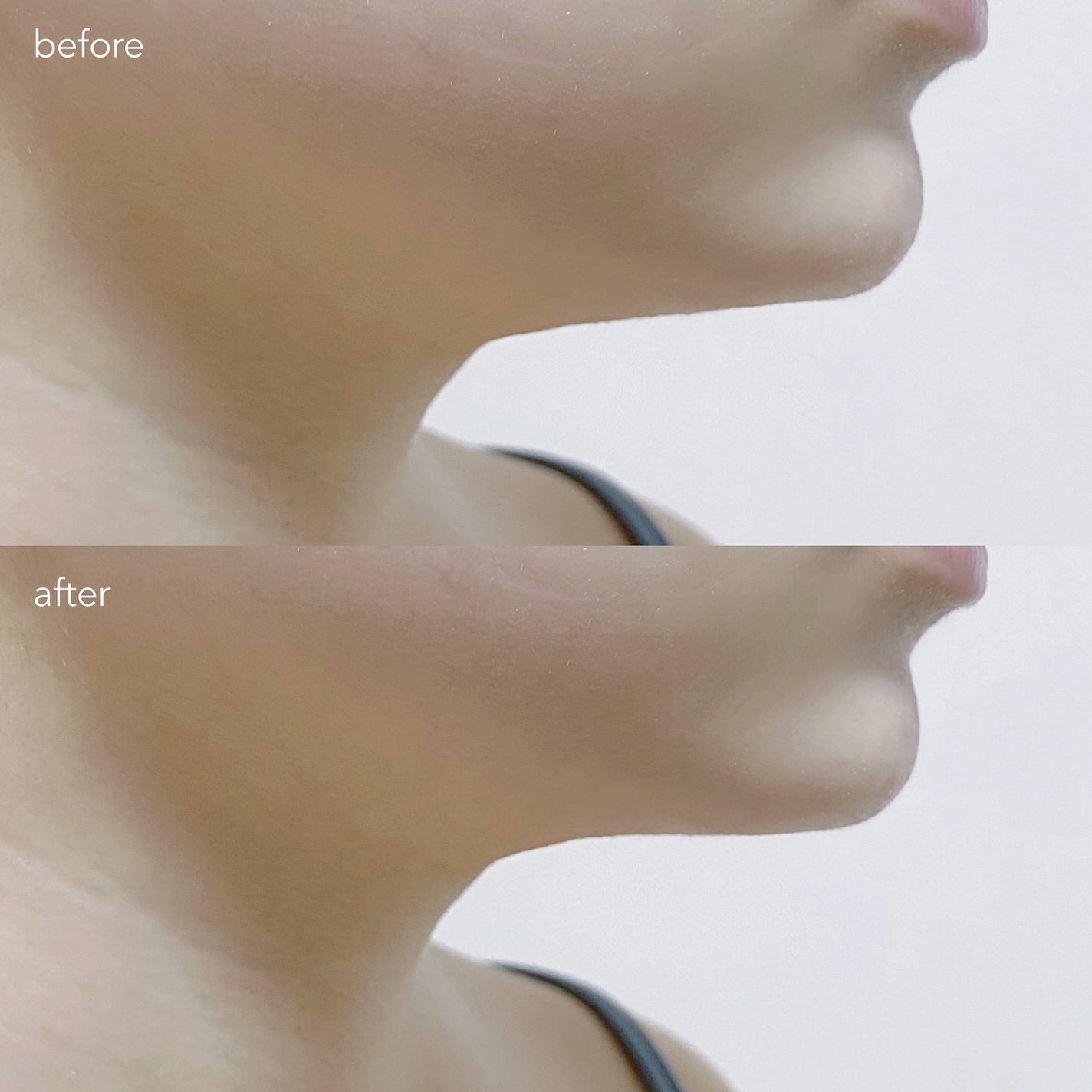 9番 NMNバイオリフトラッピングマスク/numbuzin/シートマスク・パックを使ったクチコミ(7枚目)