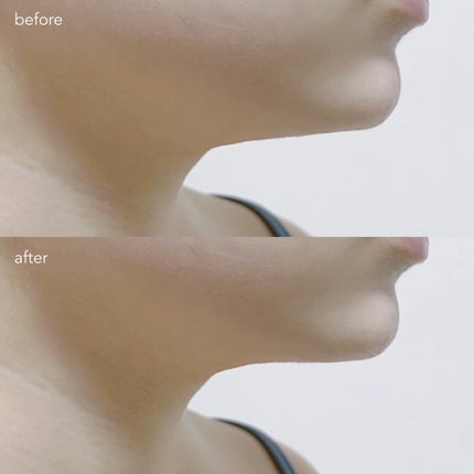 9番 NMNバイオリフトラッピングマスク/numbuzin/シートマスク・パックを使ったクチコミ(7枚目)