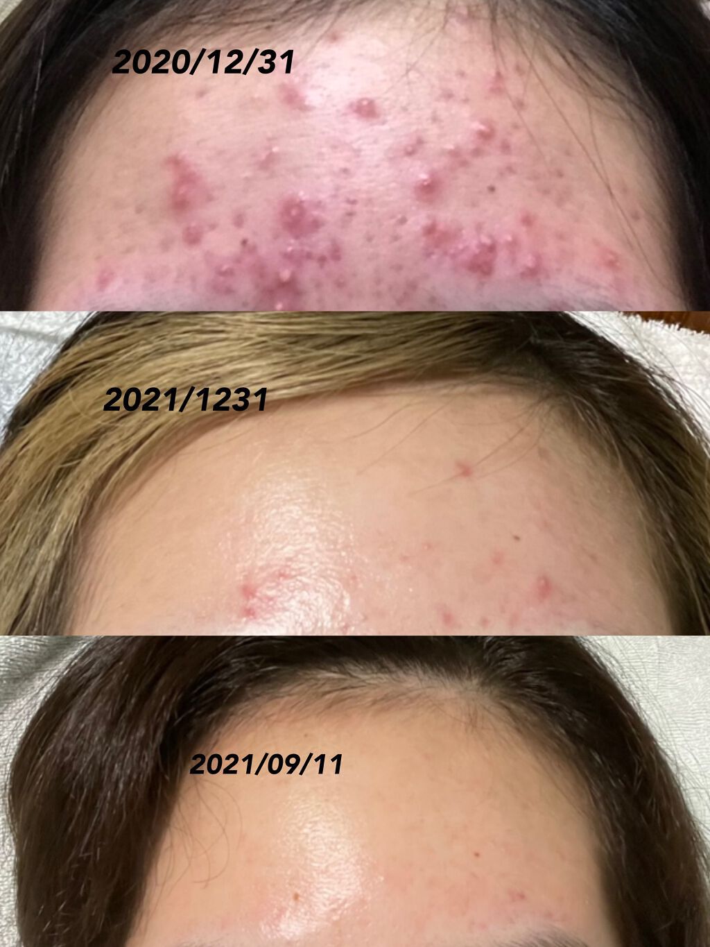 イハダ 薬用バーム【医薬部外品】/IHADA/フェイスバームを使ったクチコミ(2枚目)