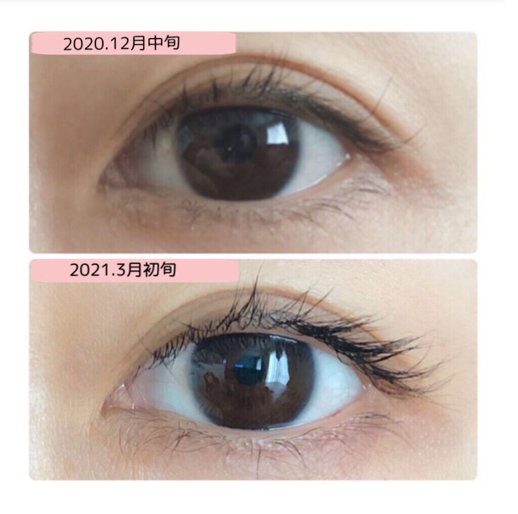 エグータム/アルマダスタイル/まつげ美容液を使ったクチコミ(4枚目)