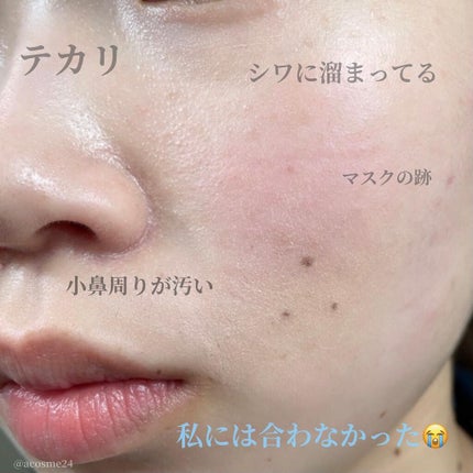 【旧】ディオールスキン フォーエヴァー スキン コレクト コンシーラー/Dior/リキッドコンシーラーを使ったクチコミ(8枚目)