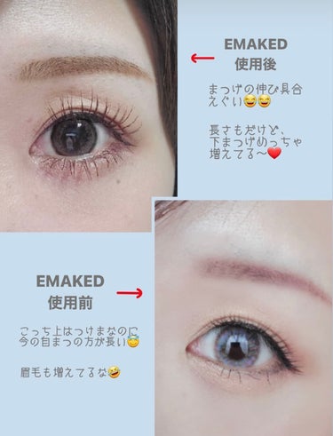 EMAKED（エマーキット）/水橋保寿堂製薬/まつげ美容液を使ったクチコミ（2枚目）