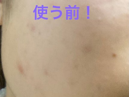 CICA デイリースージングマスク/VT/シートマスク・パックを使ったクチコミ(3枚目)