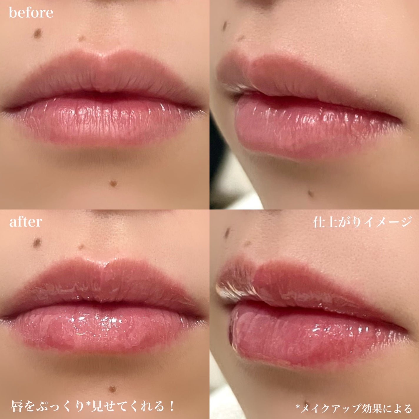 ドトムリッププラスプランパー/keybo/リッププランパーを使ったクチコミ(4枚目)