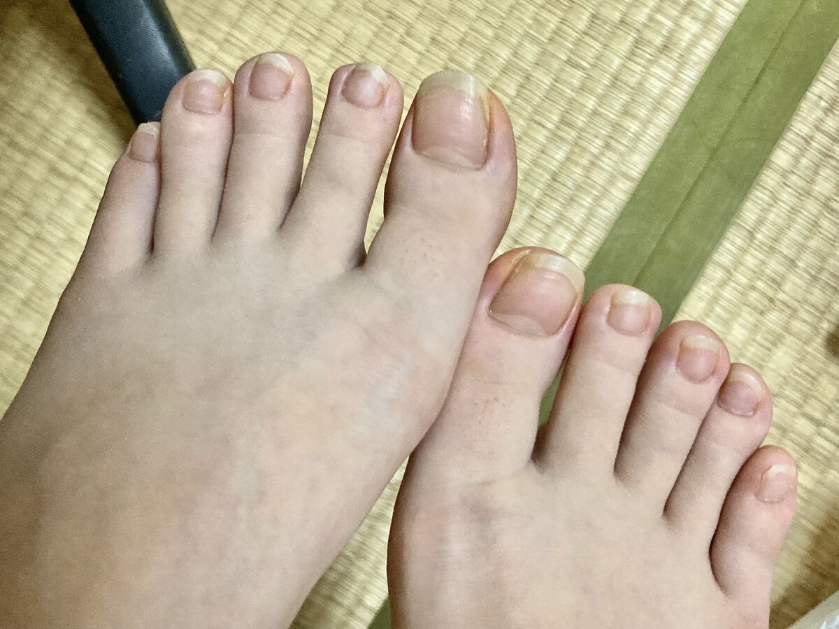 キューティクルオイル/ネイルホリック/ネイルオイル・トリートメントを使ったクチコミ（1枚目）