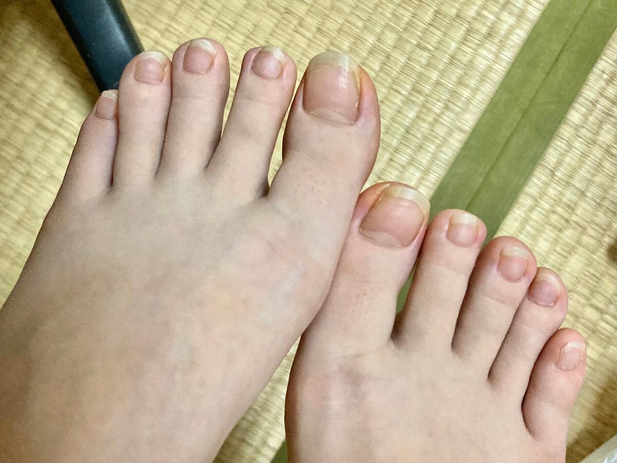 キューティクルオイル/ネイルホリック/ネイルオイル・トリートメントを使ったクチコミ(1枚目)