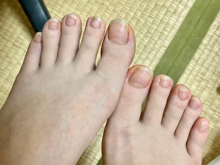キューティクルオイル/ネイルホリック/ネイルオイル・トリートメントを使ったクチコミ(1枚目)