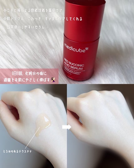 ゼロ毛穴パッド 2.0/MEDICUBE/トナーパッドを使ったクチコミ(6枚目)